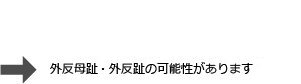 外反母趾、外反趾可能性のがあります。