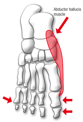 abductor hallucis muscle